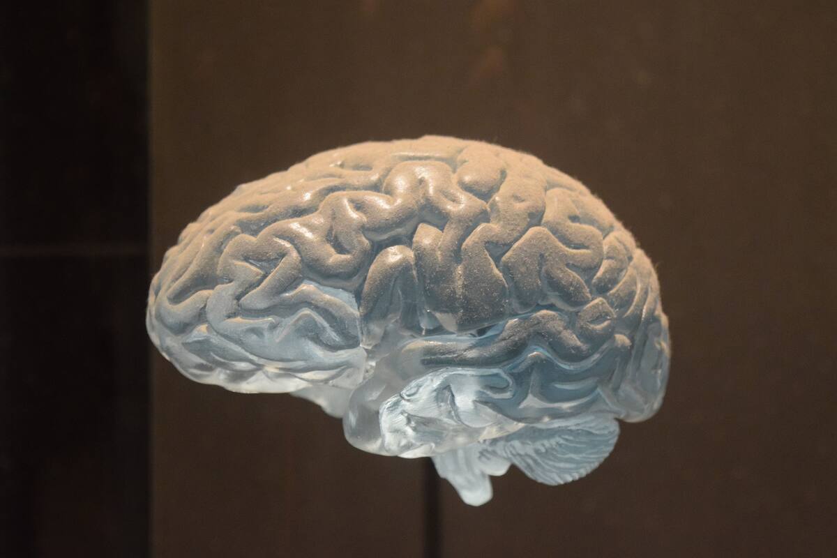 Lecanemab: ¿Qué se sabe sobre el fármaco que podría ayudar a combatir el Alzheimer?