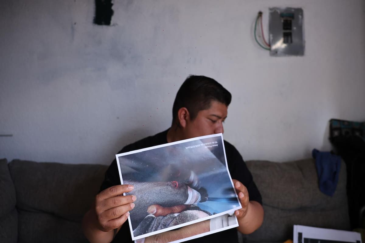 Dueño de pitbull ofrece apoyo a víctima; denuncia agresión a su perro
