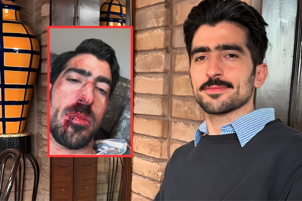 Influencer Jezzini alarma a seguidores al aparecer con el rostro ensangrentado