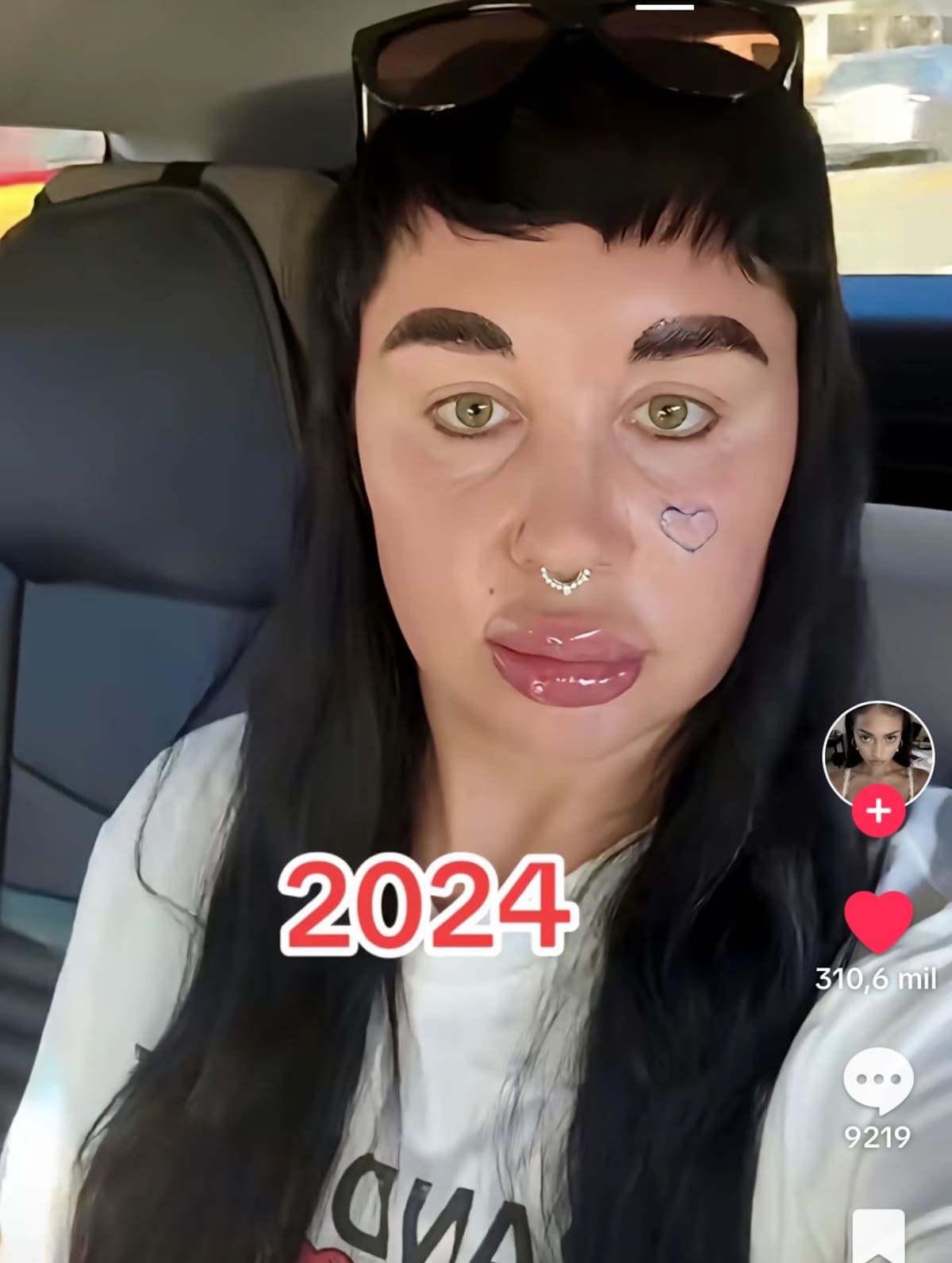 Amanda Bynes el antes y después. Instagram.