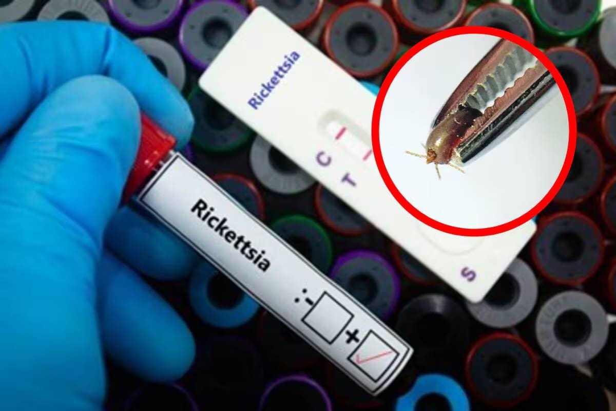 55 casos de rickettsia se han registrado en BC este año