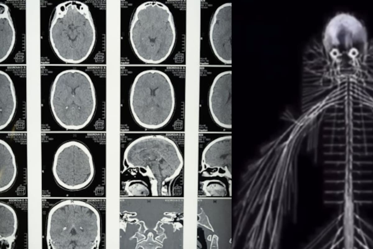 ¿Quién es Harriet Cole? Así se logró estudiar más a fondo el sistema nervioso