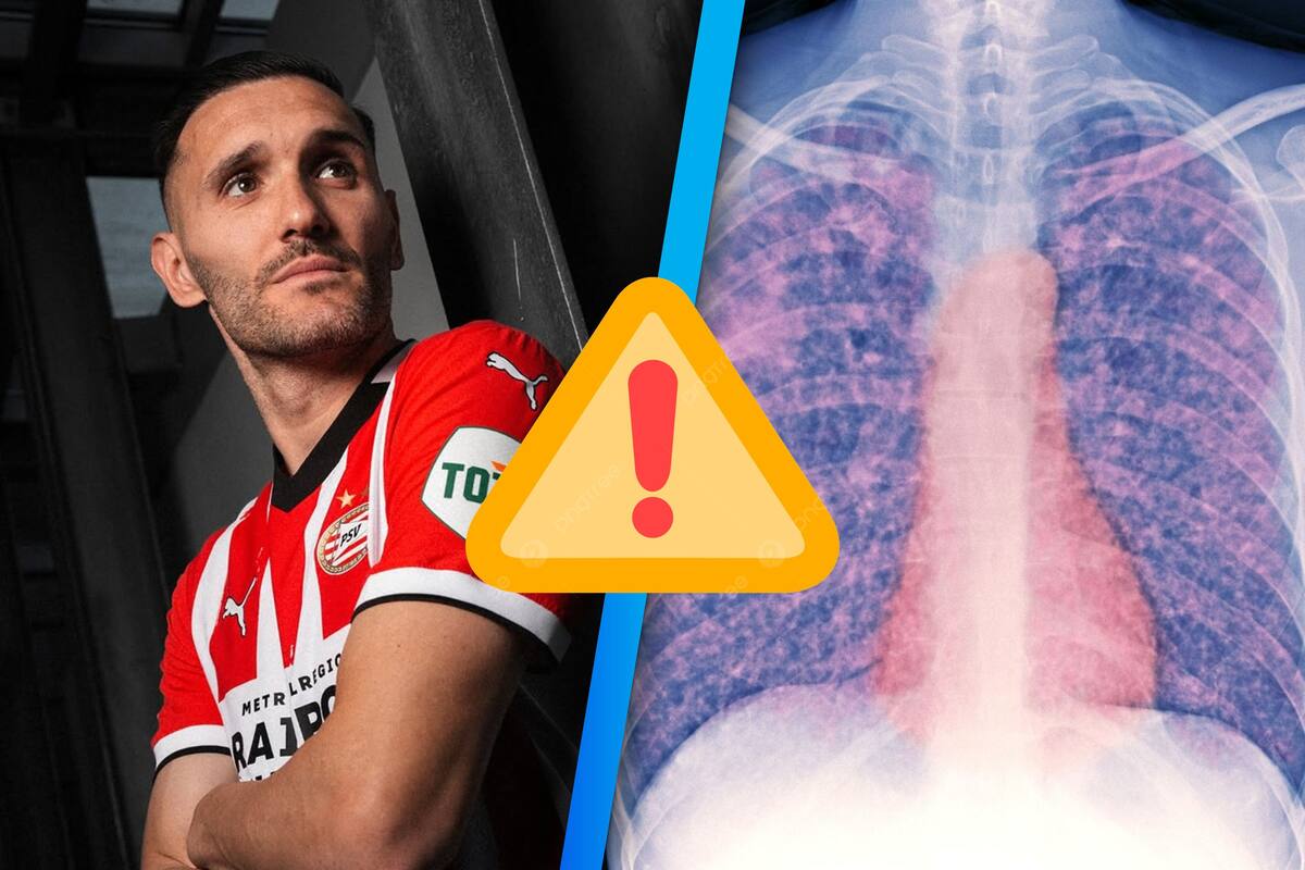 Lucas Pérez del PSV es baja por tuberculosis ¡Alerta de contagio en el vestuario! (Informes)