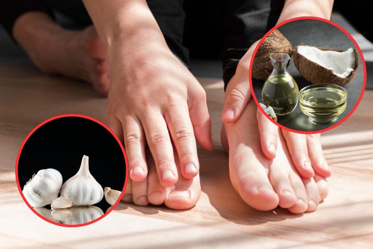 Cómo eliminar hongos en las uñas con ajo y aceite de coco