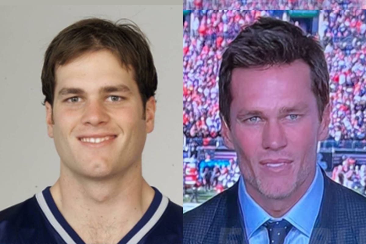 Redes sociales comparan a Tom Brady con el meme de ‘Calamardo Guapo’