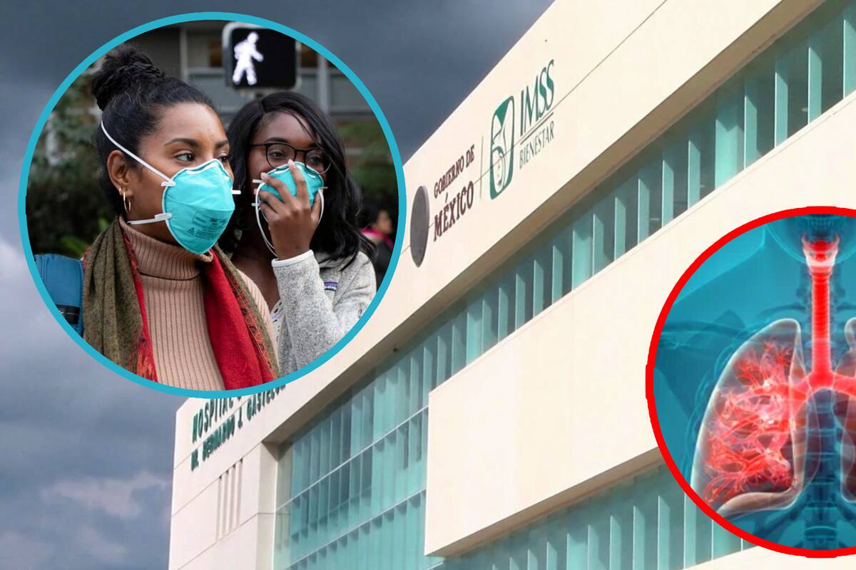 Confirman 150 casos de Metapneumovirus en Sinaloa: ¿Hay riesgos?