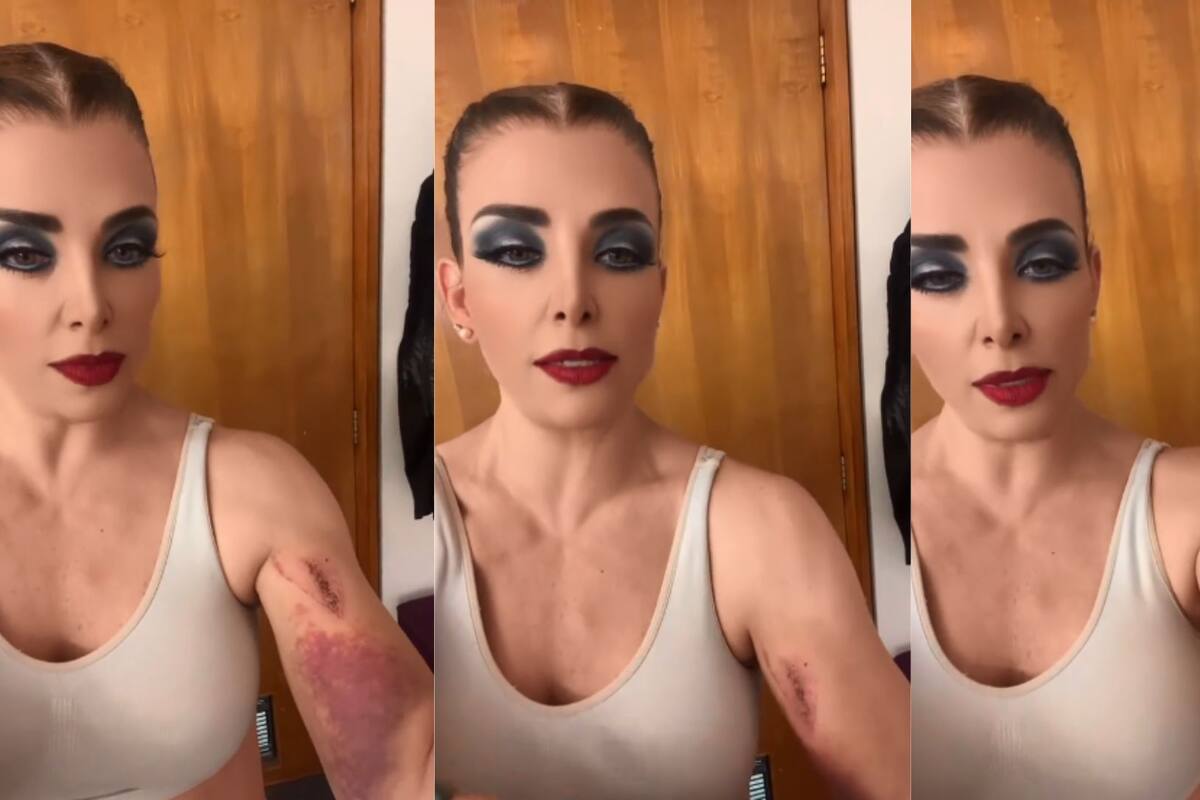 Lisset se lesiona al caer en coladera y lanza fuerte reclamo a las autoridades
