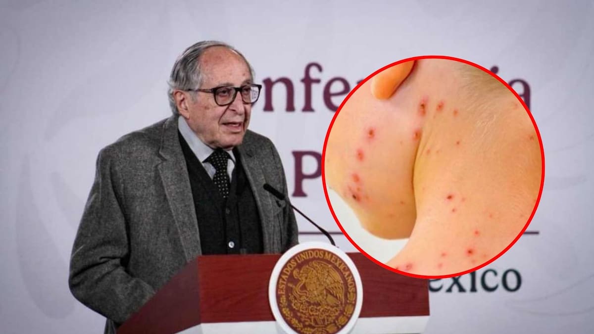 Secretaría de Salud presenta estrategia para erradicar el sarampión en México y garantiza vacunas por dos años | Presidencia