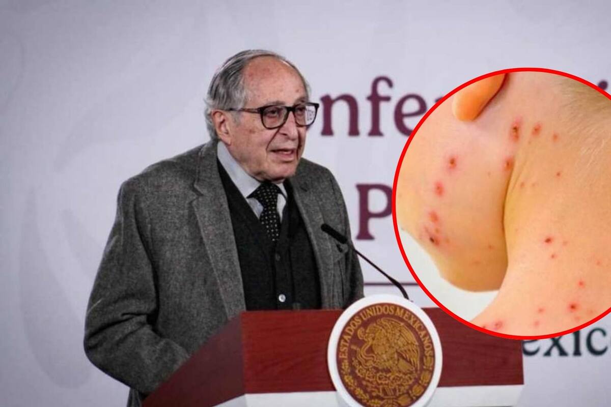 Secretaría de Salud presenta estrategia para erradicar el sarampión en México y garantiza vacunas por dos años