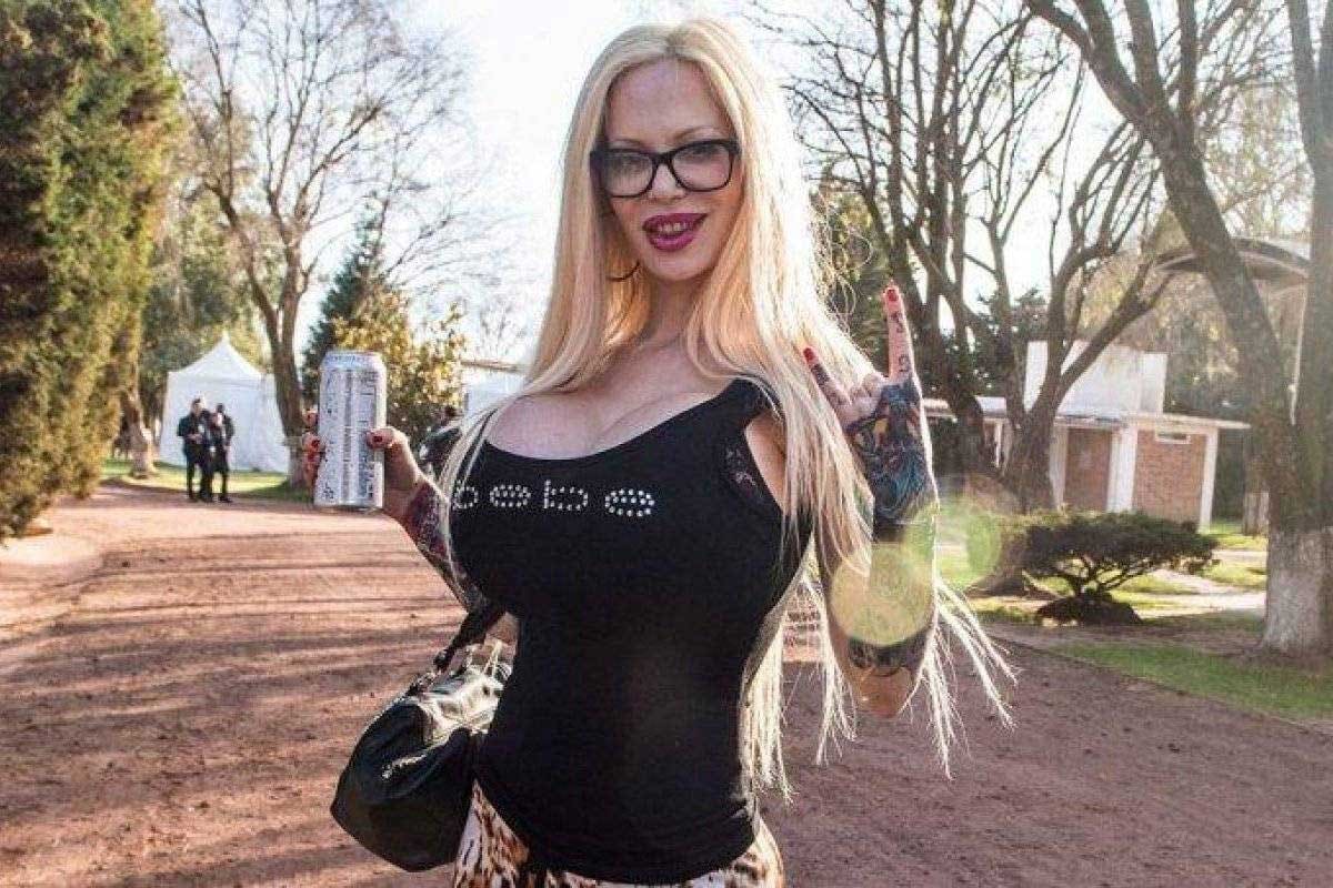 Sabrina va por su cirugía número 52