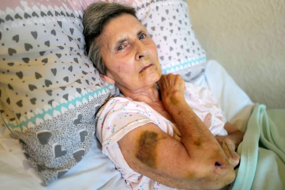 Inglaterra: Rata atacó a una anciana mientras dormía; "había sangre por todas partes"
