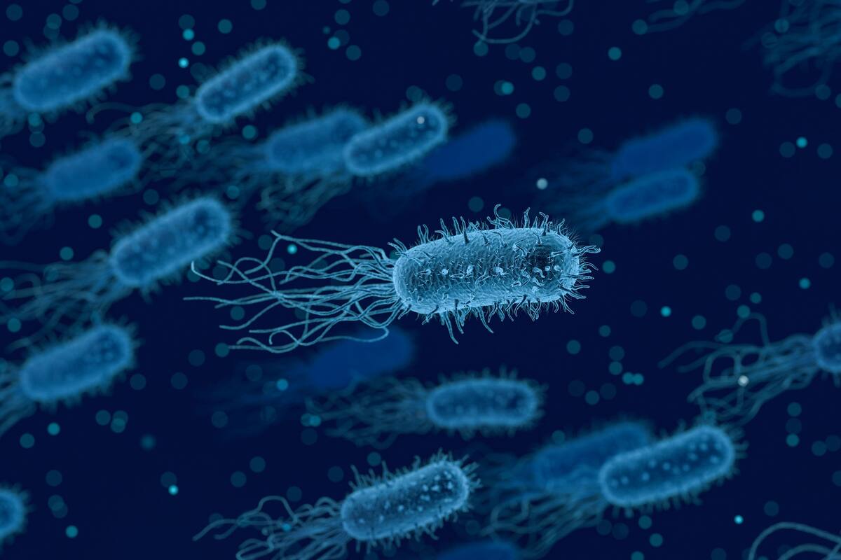 ¿Qué es la listeria? Una microbióloga explica la bacteria detrás de los recientes brotes mortales de intoxicación alimentaria