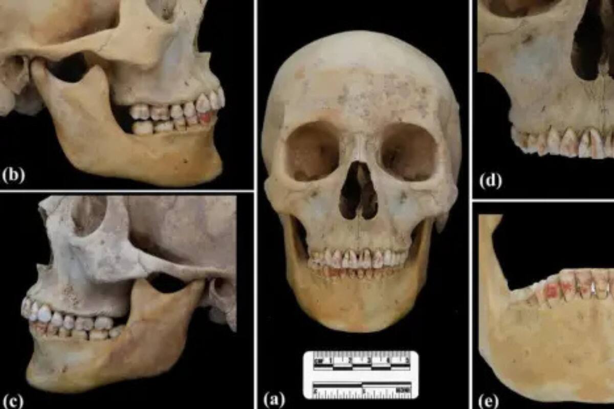 Descubren en China restos de una mujer de hace 2,000 años que usó un pigmento tóxico para pintarse los dientes