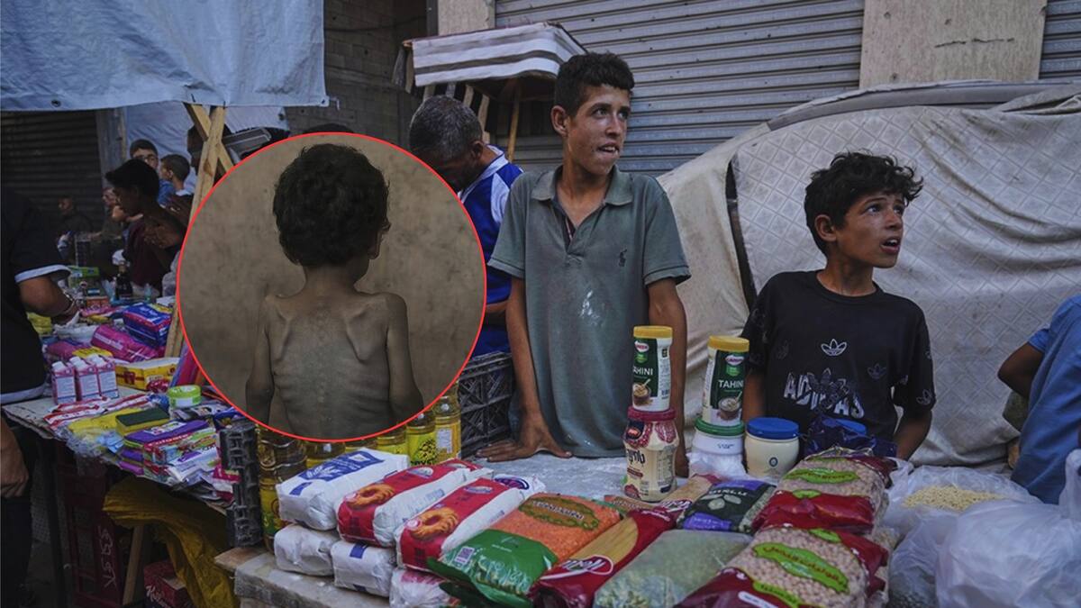 La Franja de Gaza enfrenta una emergencia alimentaria sin precedentes. Foto: Especial (AP)