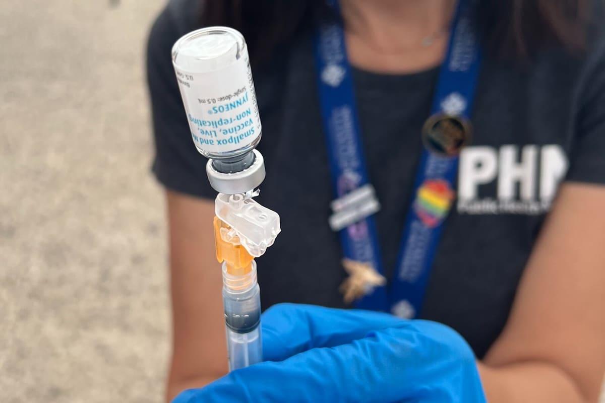 Aumentan casos del virus del mono al doble en San Diego