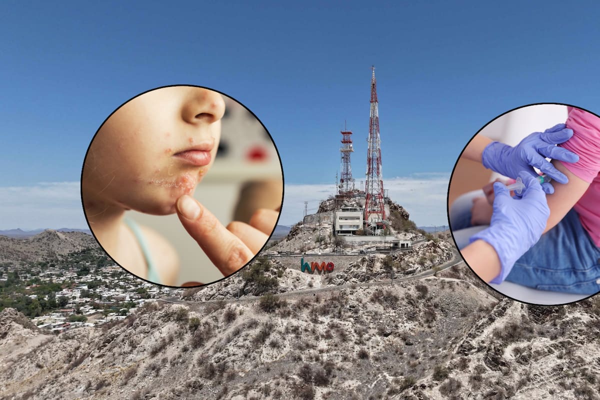 Suspenden clases en Secundaria Técnica 72 de Hermosillo por brote de varicela