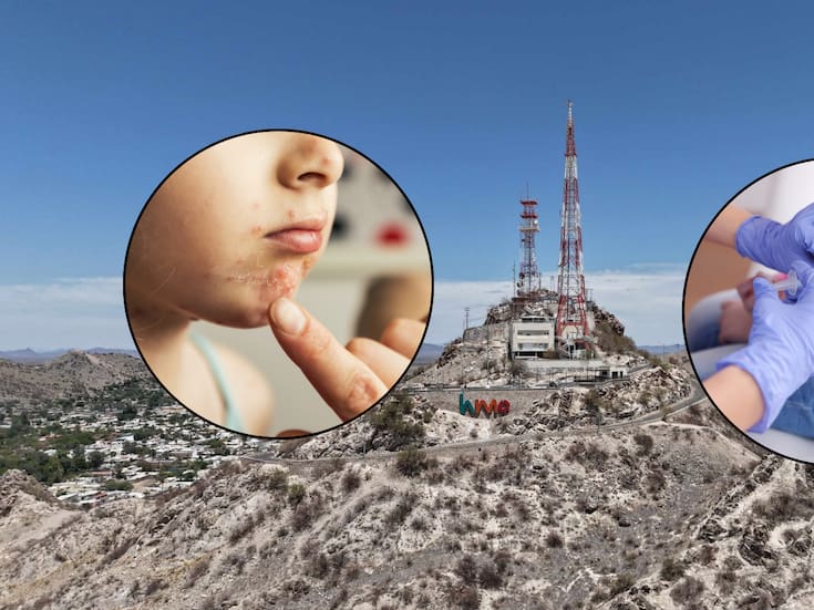 Padres de familia de la Secundaria Técnica Número 72 decidieron no enviar a sus hijos tras un brote de varicela; entre 20 y 30 alumnos se contagiaron en la última semana