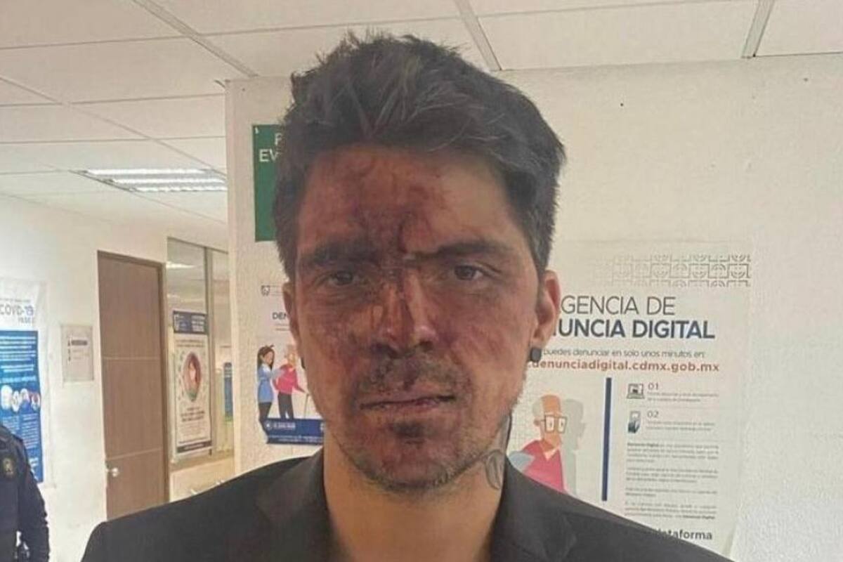 Recibe golpiza hijo de Lupita D'Alessio
