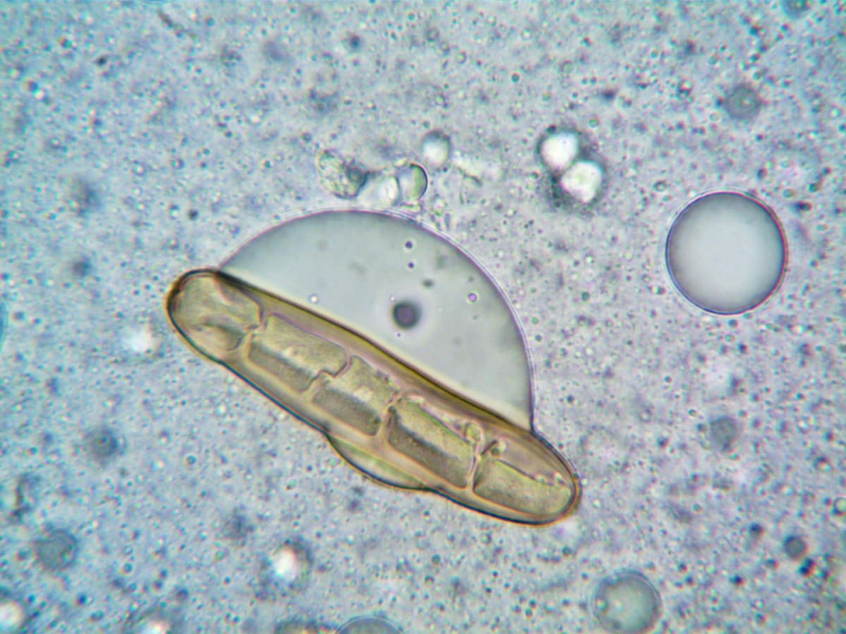 Investigaciones posteriores también relacionaron brotes de criptosporidiosis con jugo de manzana no pasteurizado contaminado tras el uso de estiércol de ganado en cultivos. Foto: Pexels.