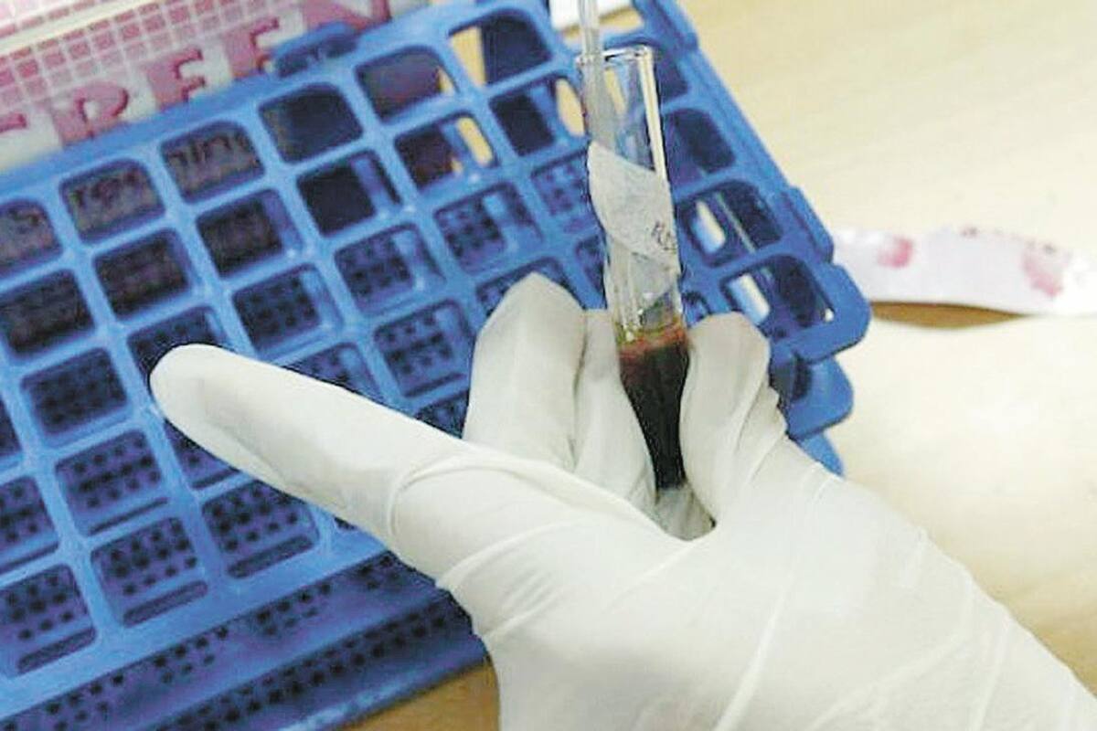 Realizarán jornadas para detectar casos de hepatitis C