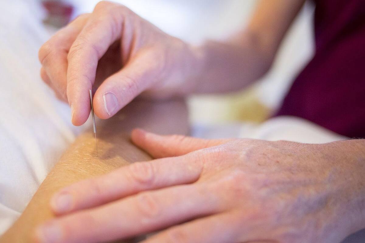 ¿La acupuntura miente? Científico examina la medicina tradicional