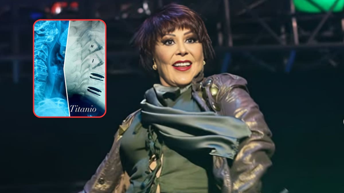 Alejandra Guzmán impacta al mostrar radiografía de su columna tras una delicada cirugía