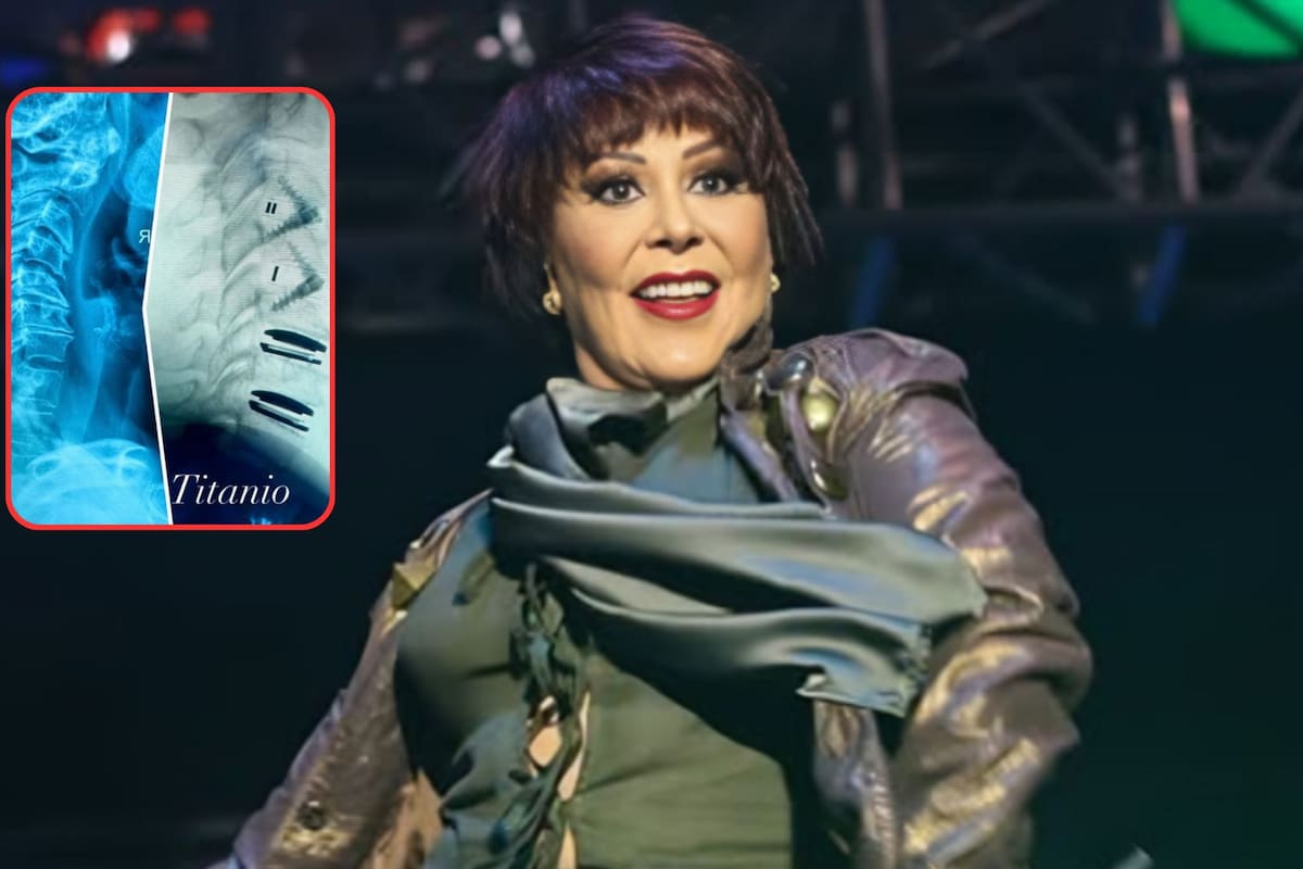Alejandra Guzmán impacta al mostrar radiografía de su columna tras una delicada cirugía