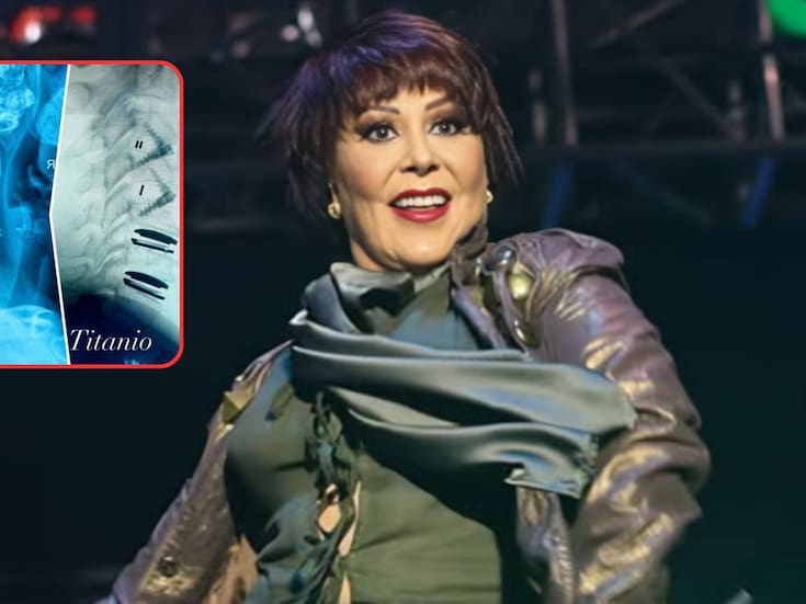Alejandra Guzmán impacta al mostrar radiografía de su columna tras una delicada cirugía