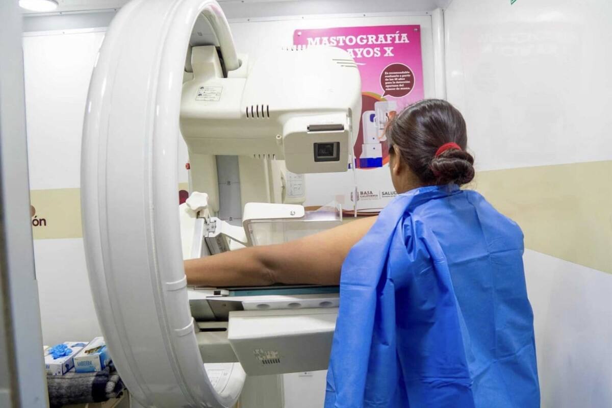 Llaman a mujeres de 40 años en adelante a realizarse la mastografía