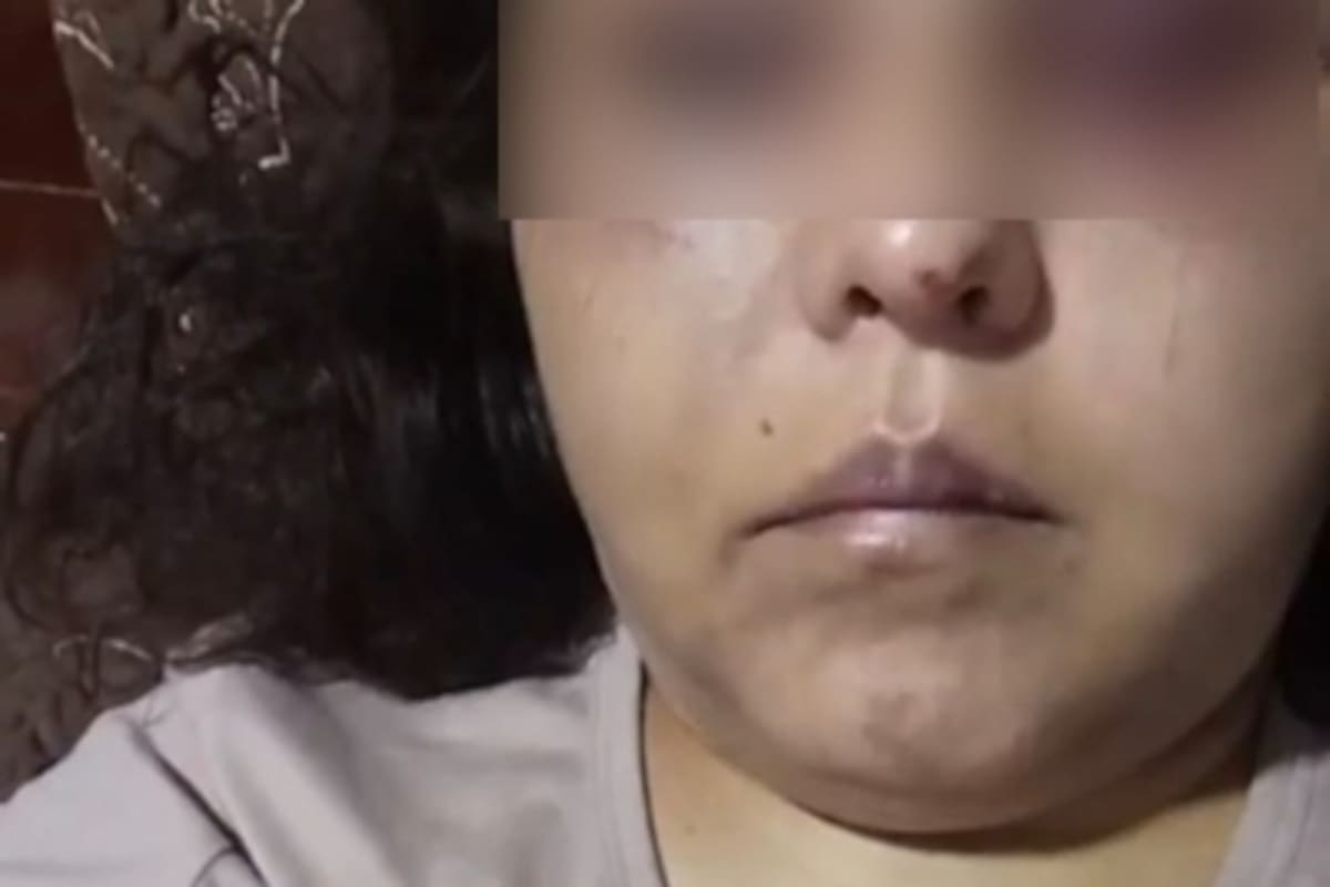 Joven madre denuncia intento de feminicidio; acusa a su expareja de brutal agresión