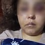 Joven madre denuncia intento de feminicidio; acusa a su expareja de brutal agresión