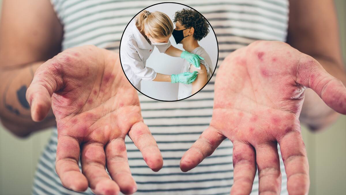 Continúan jornadas de vacunación en Cajeme tras brote de sarampión. Foto: Canvas