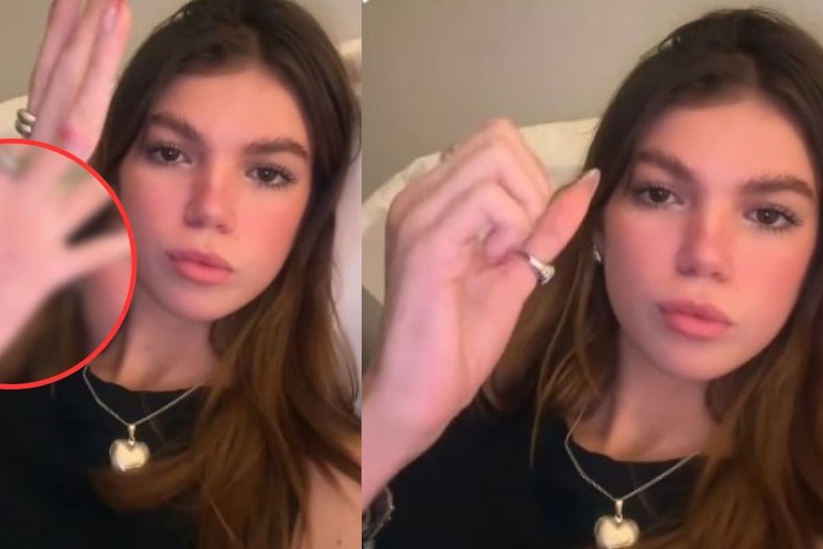 Valentina Gilabert muestra la cicatriz en su mano tras las críticas por su “rápida” recuperación