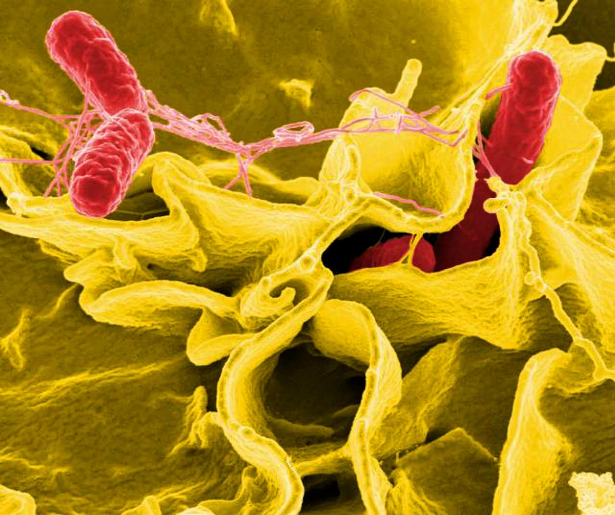 Un brote epidemiológico de salmonela registrado en el Hospital General de México Dr. Eduardo Liceaga ha afectado a más de 100 médicos residentes y personal de salud.