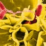 Brote de salmonela en San Diego suma 21 casos y 7 hospitalizados