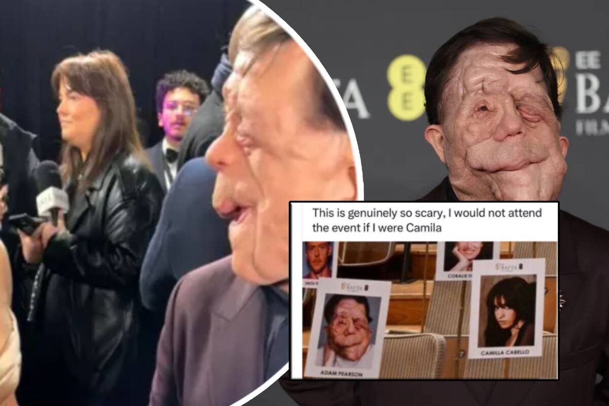 Adam Pearson responde a comentario ofensivo antes de la ceremonia de los BAFTA 2025