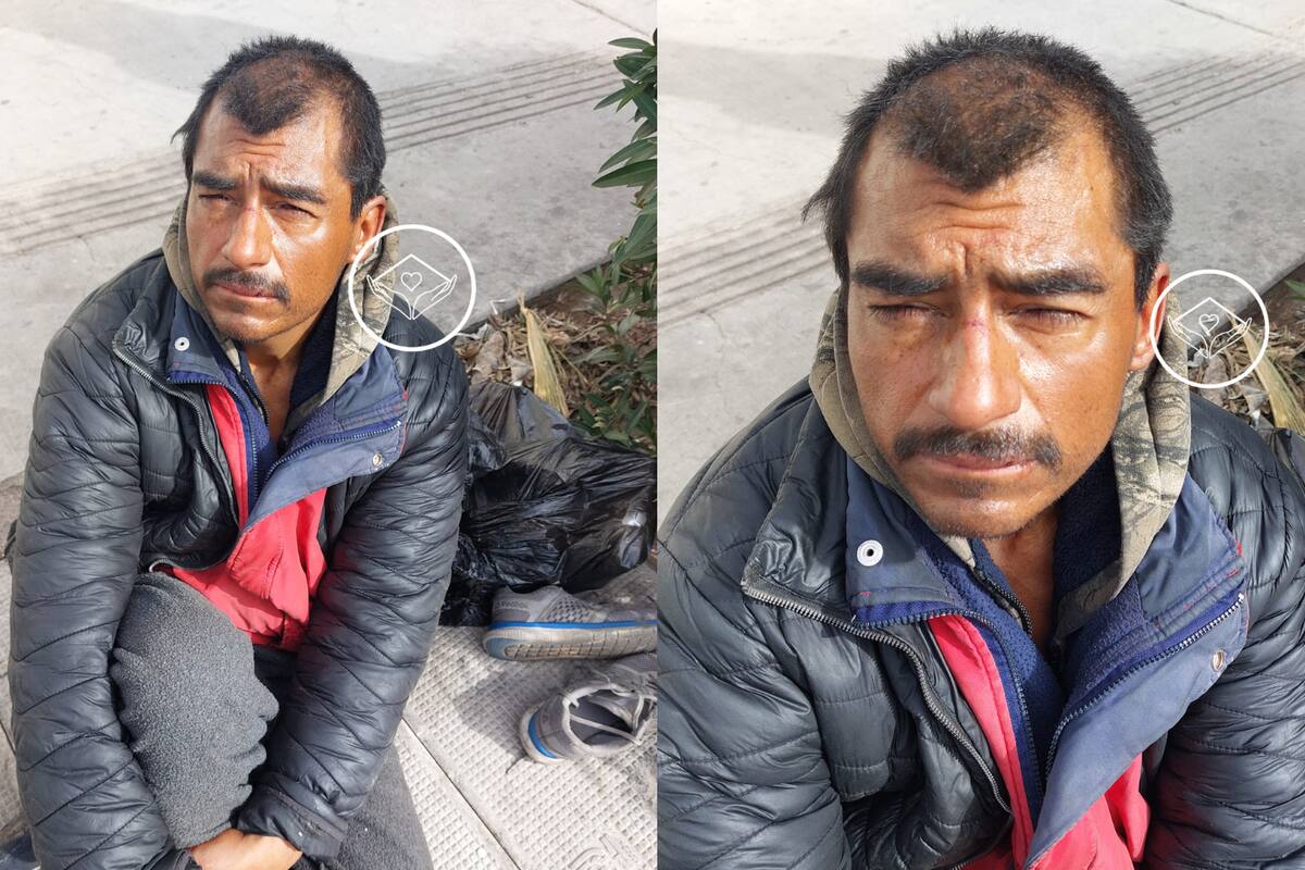 Tras picadura de una araña vive en situación de calle