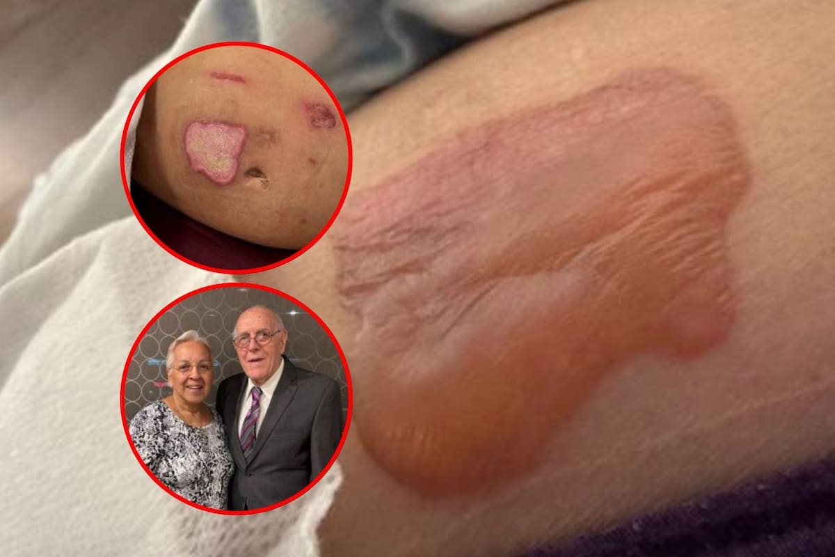 Mujer demanda a aerolínea por $10 millones tras quemaduras con café “excesivamente caliente” durante su vuelo