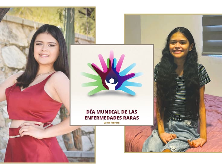 Cuando el diagnóstico no llega: Rebeca enfrenta una enfermedad rara sin rendirse ni renunciar a sus sueños