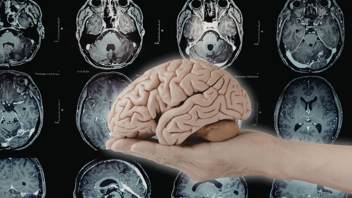 Científicos descubren que enfermedades cerebrales comparten factores de riesgo y se pueden prevenir a la vez: Estos son 17 FACTORES que afectan al mismo tiempo el riesgo de demencia, depresión y accidente cerebrovascular