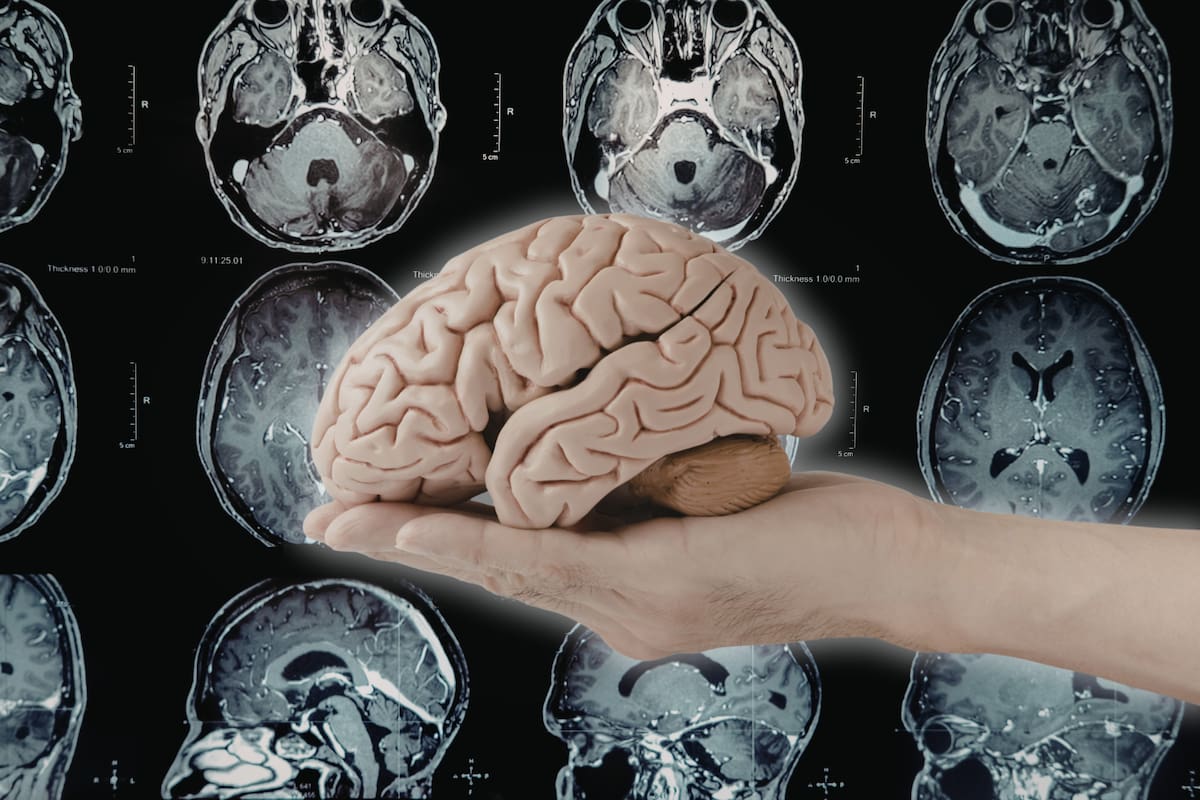 Científicos descubren que enfermedades cerebrales comparten factores de riesgo y se pueden prevenir a la vez: Estos son 17 FACTORES que afectan al mismo tiempo el riesgo de demencia, depresión y accidente cerebrovascular