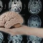 Científicos descubren que enfermedades cerebrales comparten factores de riesgo y se pueden prevenir a la vez: Estos son 17 FACTORES que afectan al mismo tiempo el riesgo de demencia, depresión y accidente cerebrovascular