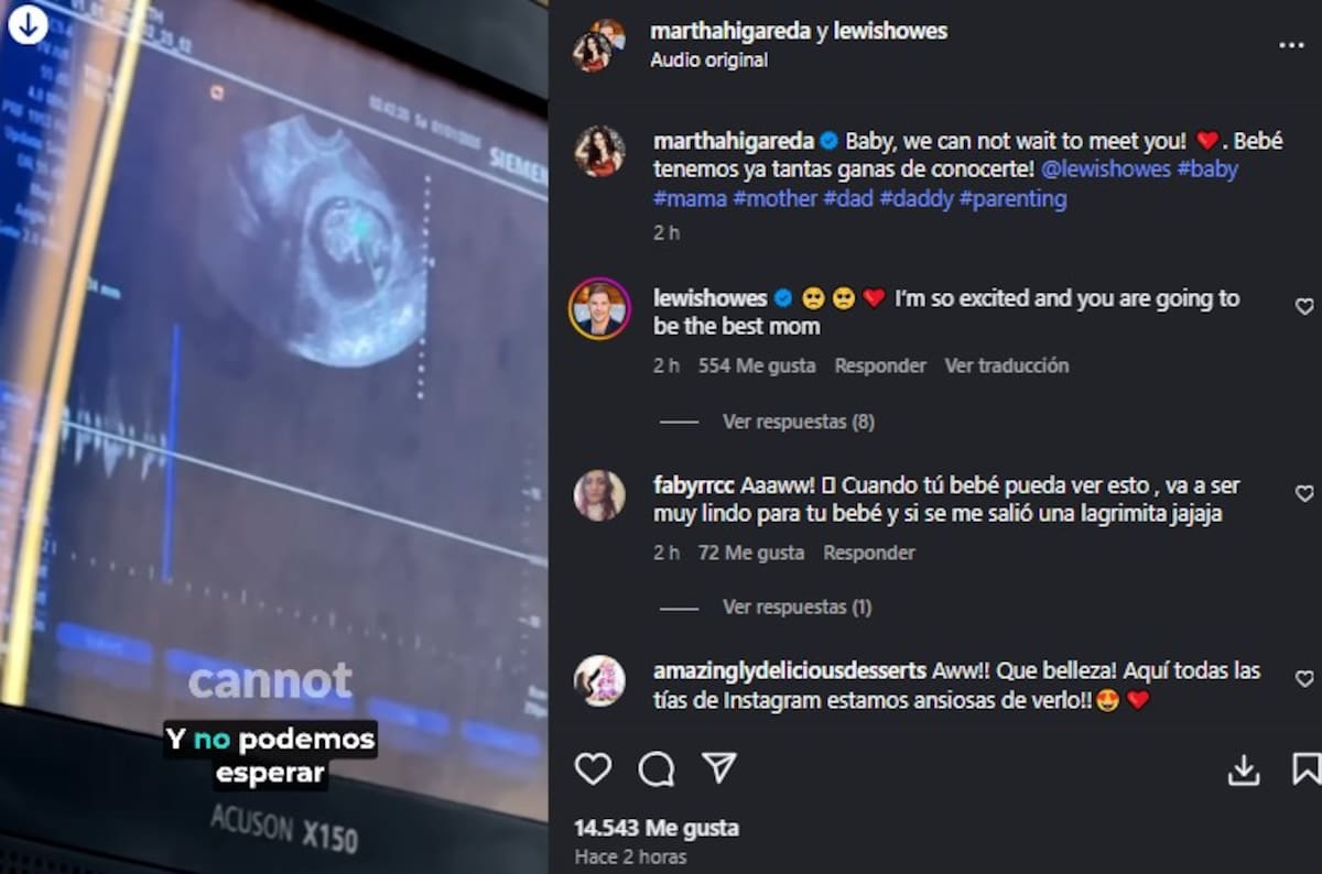 Martha Higareda comparte ultrasonidos de su bebé / Instagram @marthahigareda