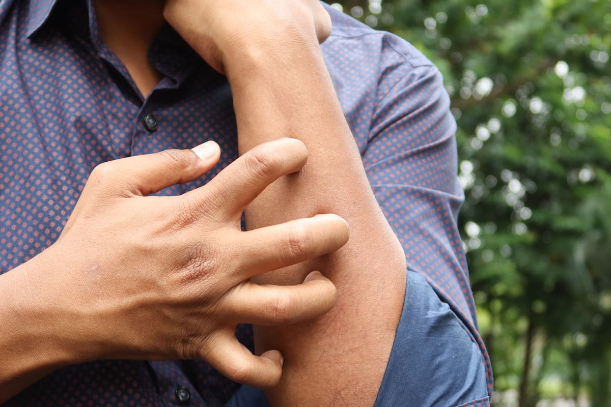 La salud intestinal puede ayudar a mejorar la salud de la piel, según expertos