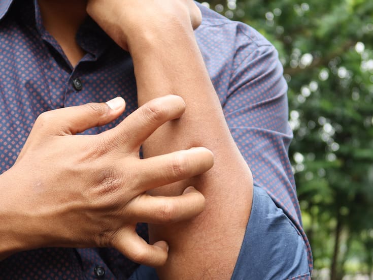 La salud intestinal puede ayudar a mejorar la salud de la piel, según expertos