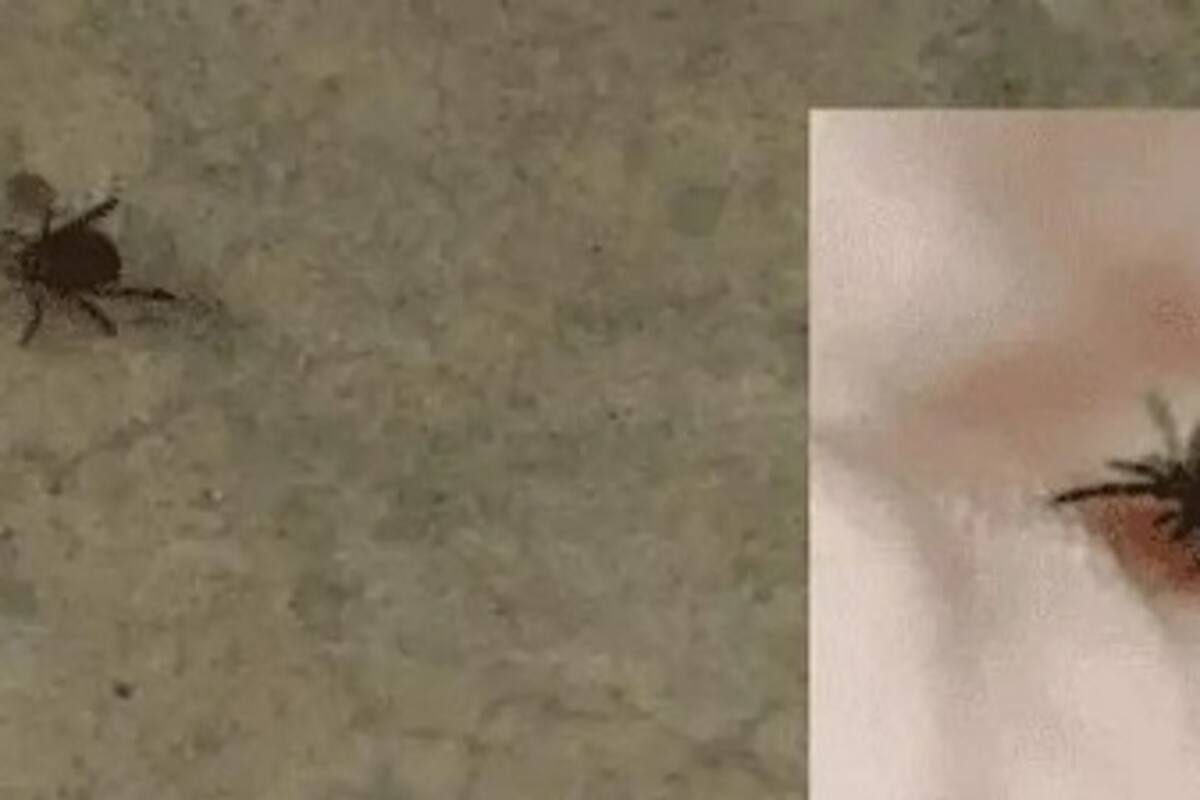 Fallecen 10 por Rickettsia en lo que va del año