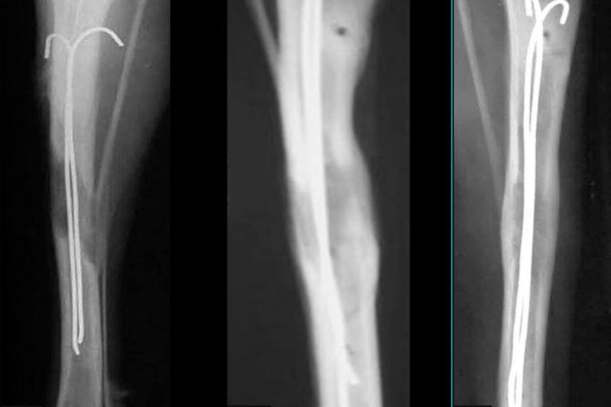 ¿Cómo se puede aumentar la estatura?