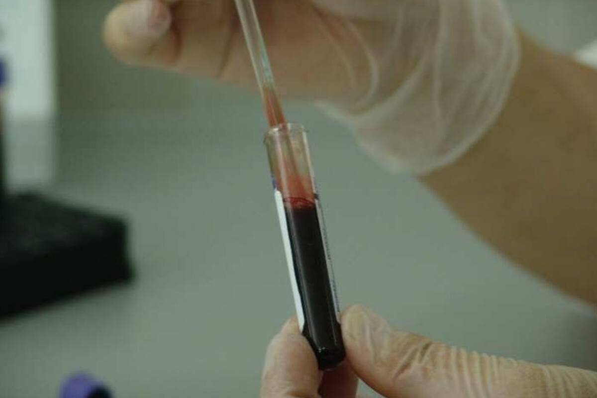 Japoneses crean sangre artificial que sirve para cualquier grupo sanguíneo
