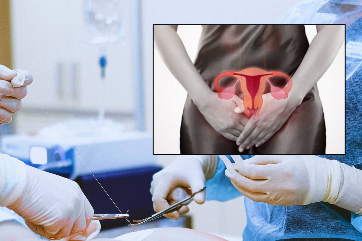 Estudio declara que la cirugía abierta es mejor a las técnicas mínimamente invasivas para tratar el cáncer cervical