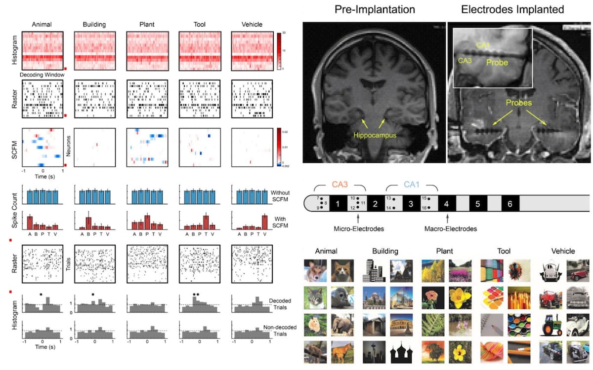 Ubicación de electrodos e imágenes utilizadas: Resonancia magnética que señala los implantes en el hipocampo (CA1 y CA3), junto a las fotografías categorizadas del experimento e histogramas de la actividad eléctrica neuronal.